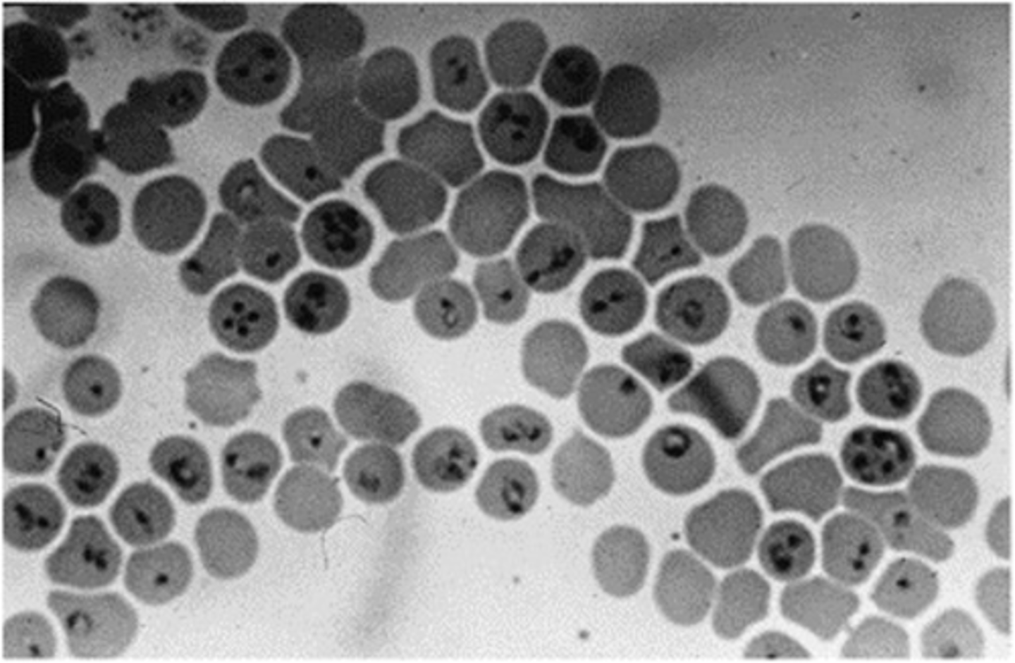 <p>Babesia equi, seen here, has been renamed to:</p>