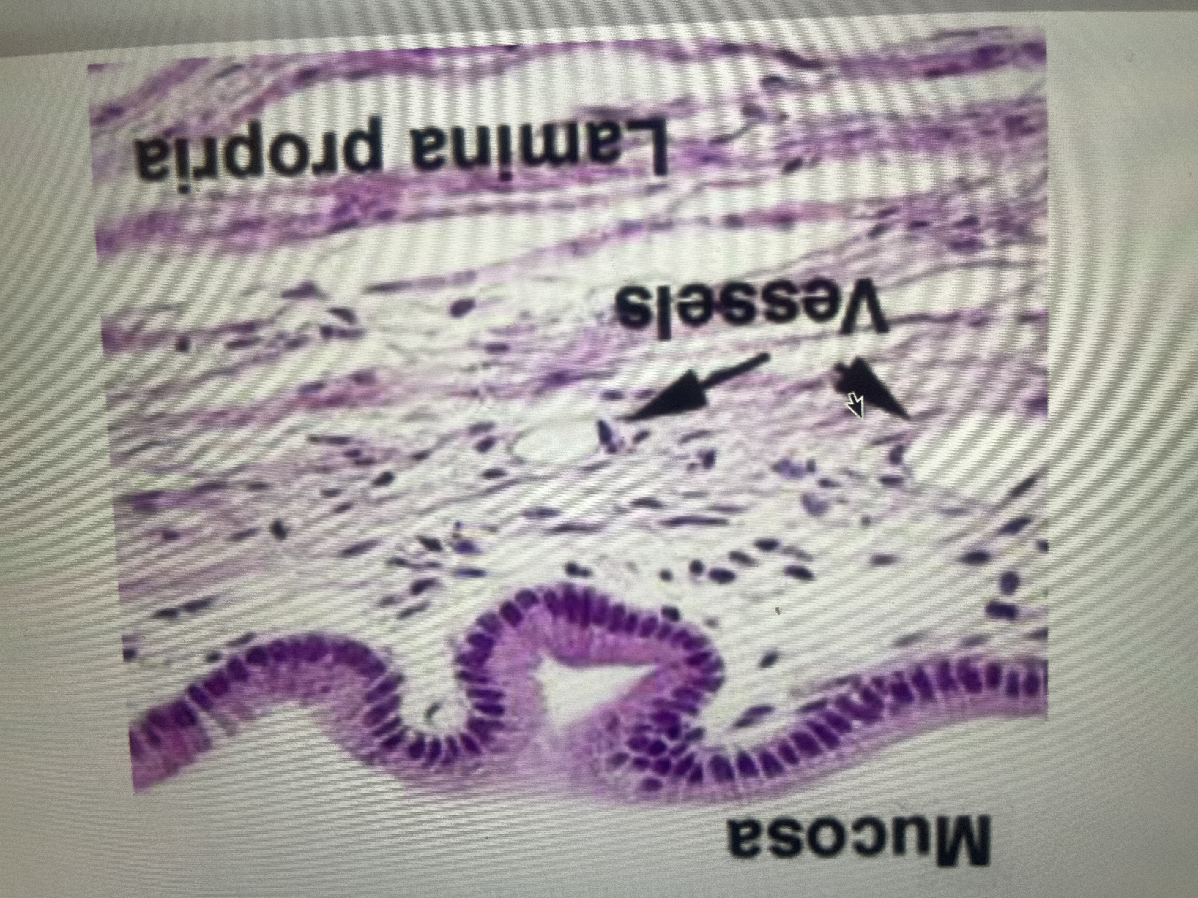 <ul><li><p>line body cavities that are open to the exterior </p></li><li><p>moist membrane bathed my secretions </p></li><li><p>epithelial sheets li over loose areolar connective tissue </p></li><li><p>may secrete mucus.</p></li><li><p>ex: mucosa of both the digestive and respiratory tracts secrete a lot of lubricating mucus</p></li></ul>