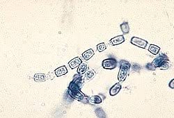 <p>CALIFORNIA AND DESERT OF SOUTHWEST US</p><p>VALLEY FEVER</p><p></p>