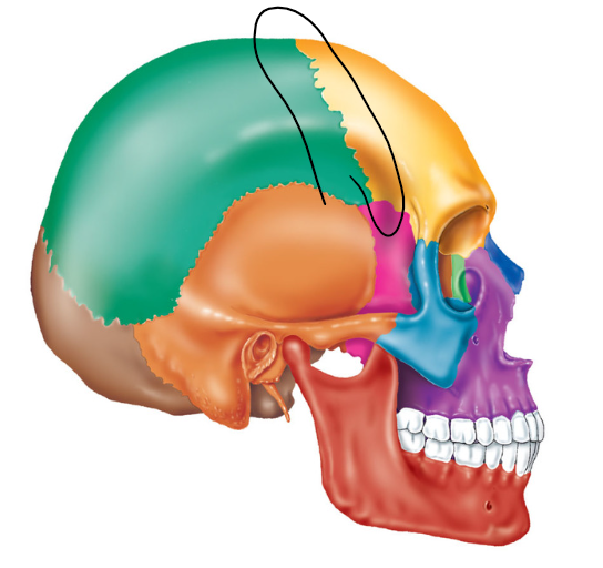 term image