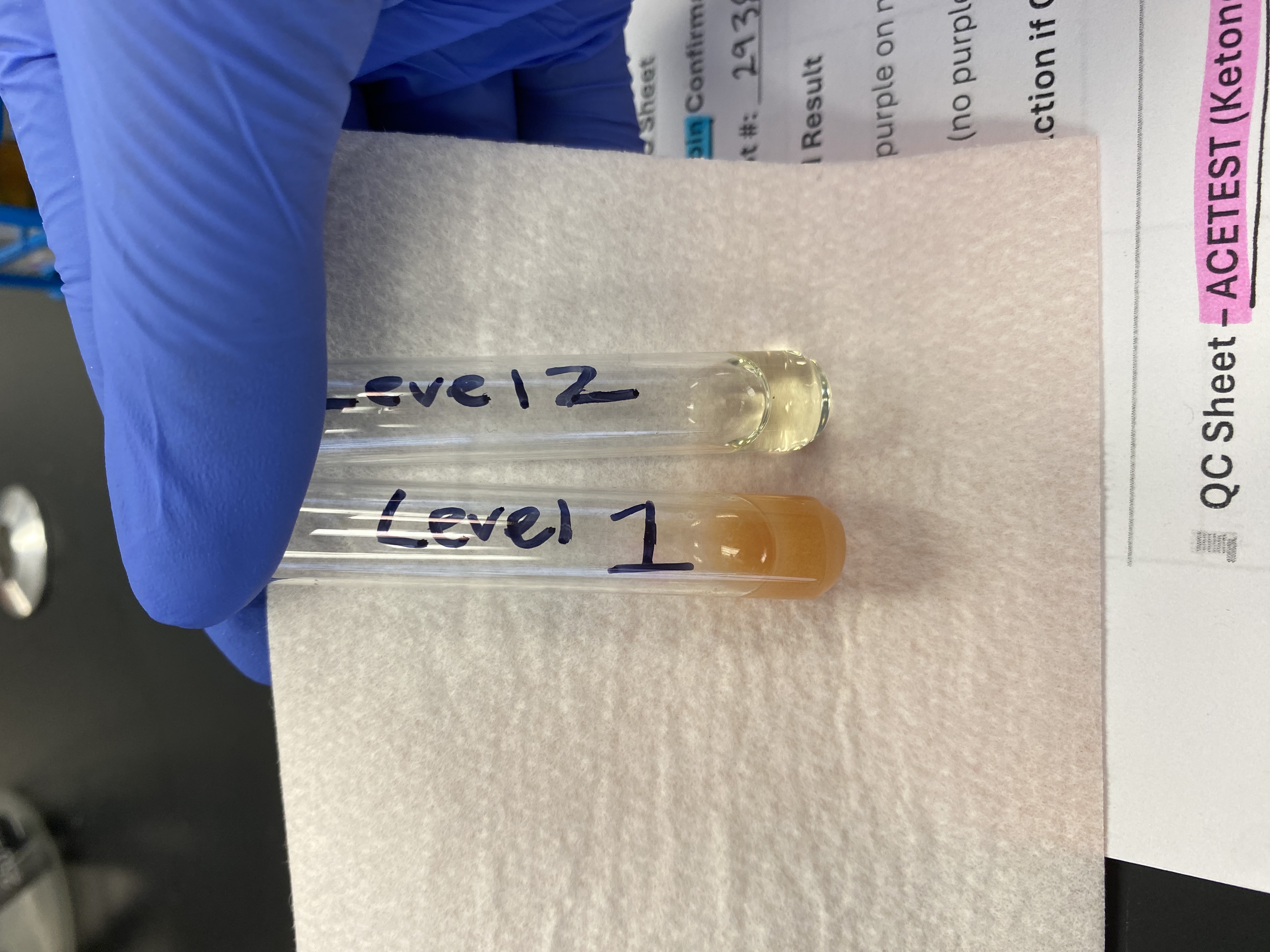 <p>SSA (Sulfosalicylic Acid)</p>