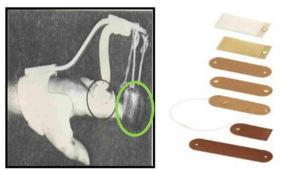 <p>Name this component of a dynamic splint. What’s its function?</p>