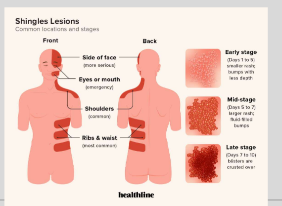 <p>DERMATOMES—> aka areas/pathways on the body that rely on a specific spinal nerve for fxn</p>
