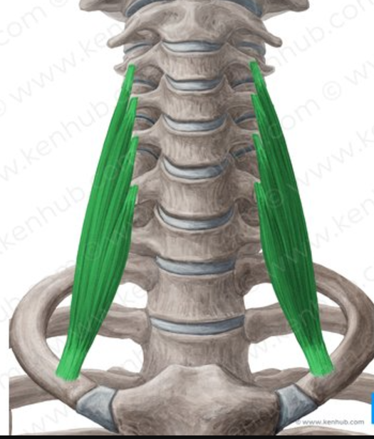 <p>Scalenus anterior origin</p>