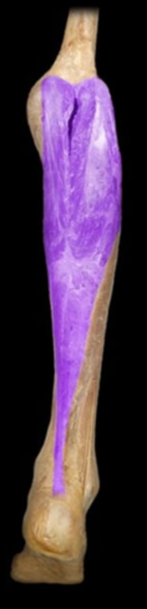 <p>What is the name of this muscle, highlighted in purple?</p>