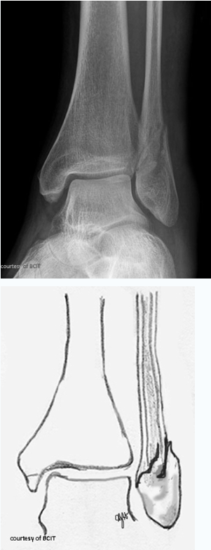 <p>which type</p>