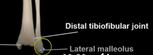 <p>now this is the bigger bone that sticks out on your ankle (on the outside of your ankle)</p><p></p><p>the distal end of the fibula is an attachment site fo ligaments holding the leg and got bones together at the ankle</p>