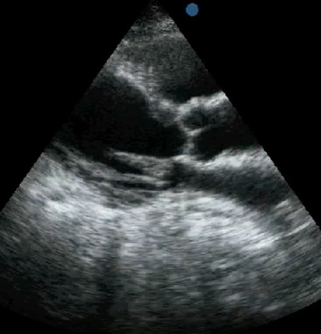 <p>Identify this image. </p>