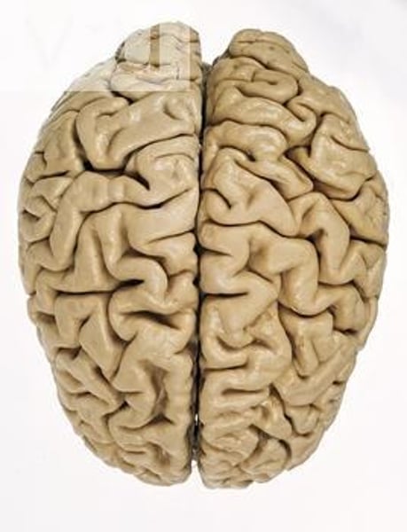 <p>name this layer</p><p>Outer layer of the cerebrum</p>