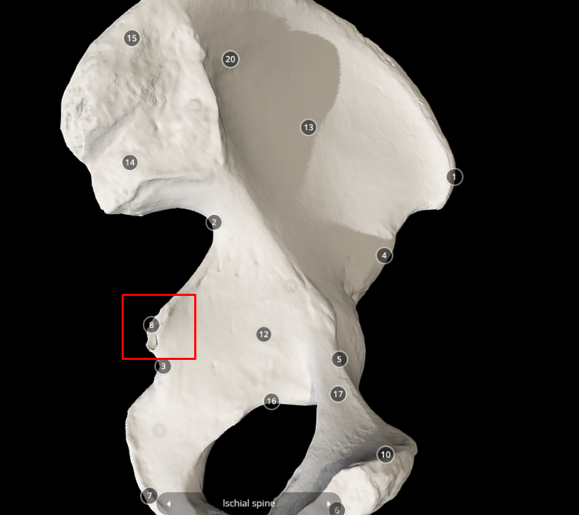 <p>ischial spine - below the greater sciatic notch</p>