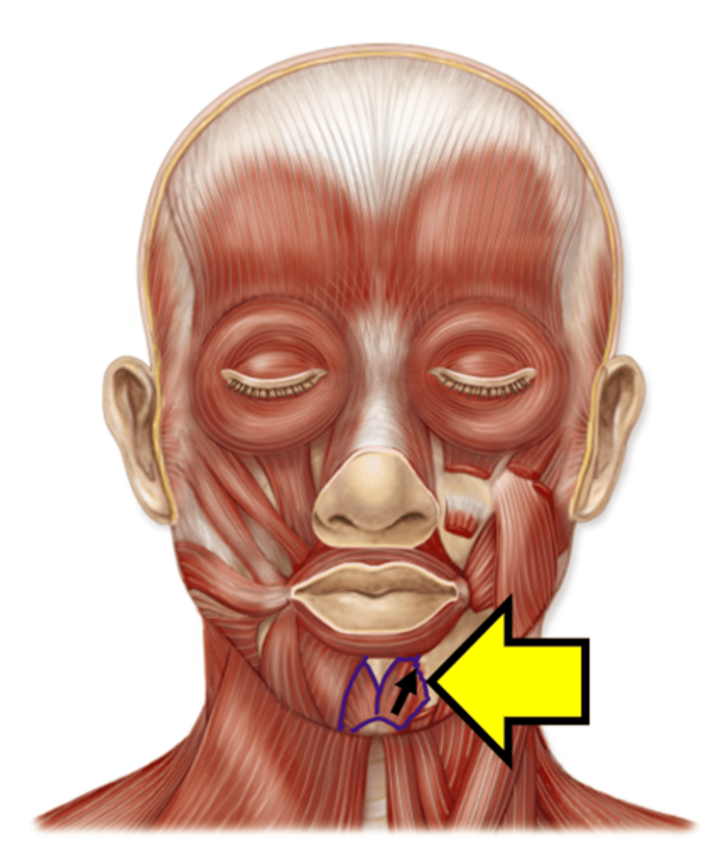 <p>Name the muscle.</p>
