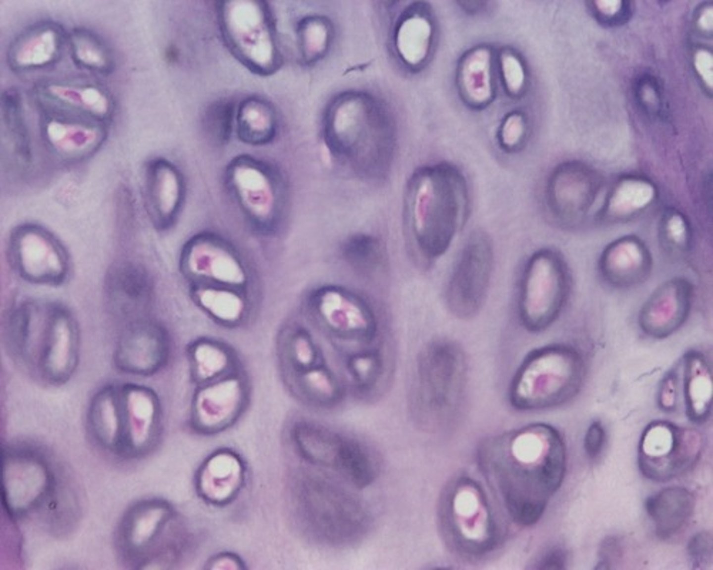 <p>Most common type of cartilage; it is found on the ends of long bones, ribs, and nose</p><p>(contains collagen fibers and chondrocytes)</p>