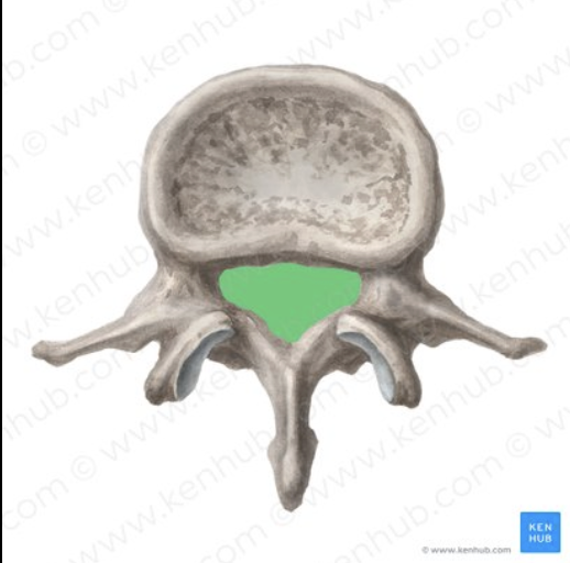 <p>What is the green portion called?</p>