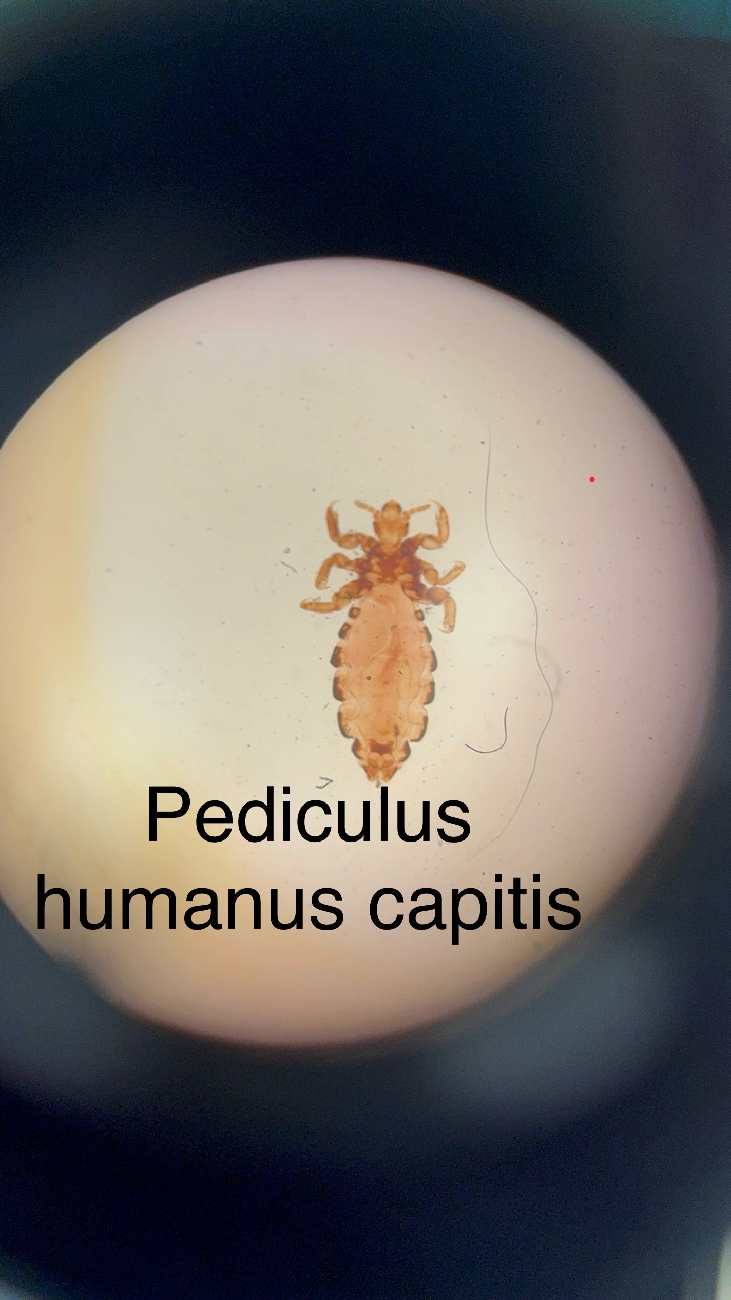 <p>Domain: Eukarya</p><p>Kingdom: Animalia</p><p>Phylum: Arthropoda</p><p>Genus: Pediculus</p><p>Species: humanus capitus</p><p>Ectoparasite</p><p>Nits = lice eggs</p><p>Causes “head lice” disease</p>