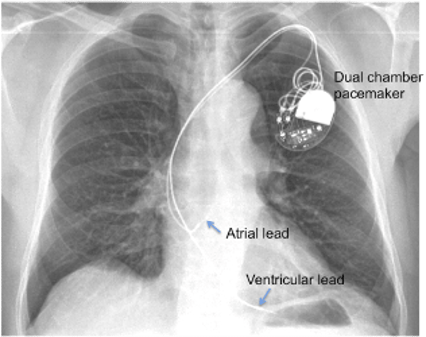 <p>what procedure</p>