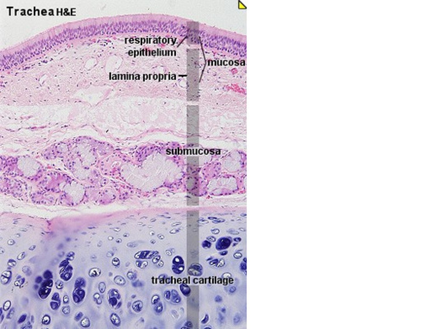 <p>C-shaped rings of cartilage joined one to another by intervening membranes of connective tissues, it is flexible but not collapsible</p>