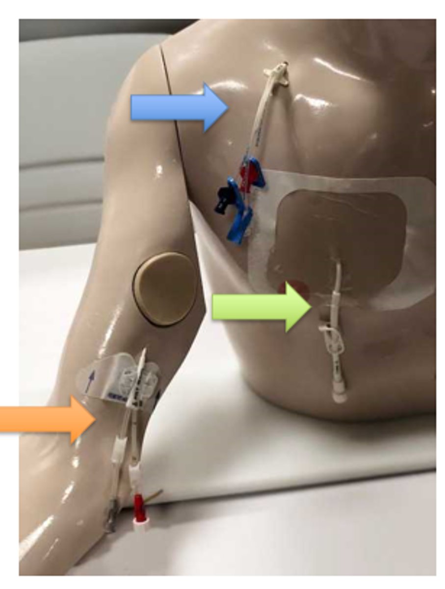 <p>What does blue arrow show?</p>