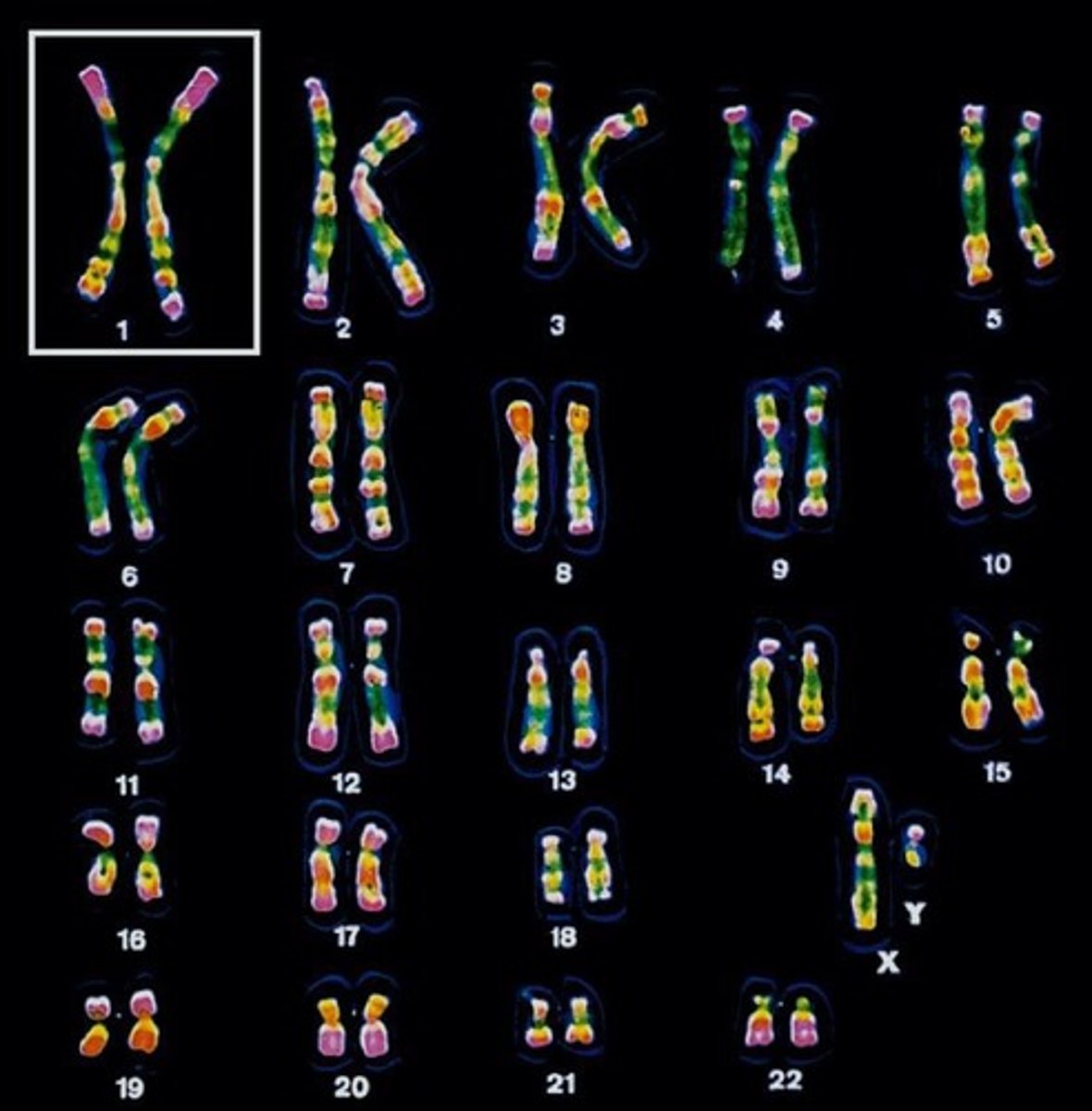 <p>A sorted set of microscope photos of all the chromosomes in a cell.</p>