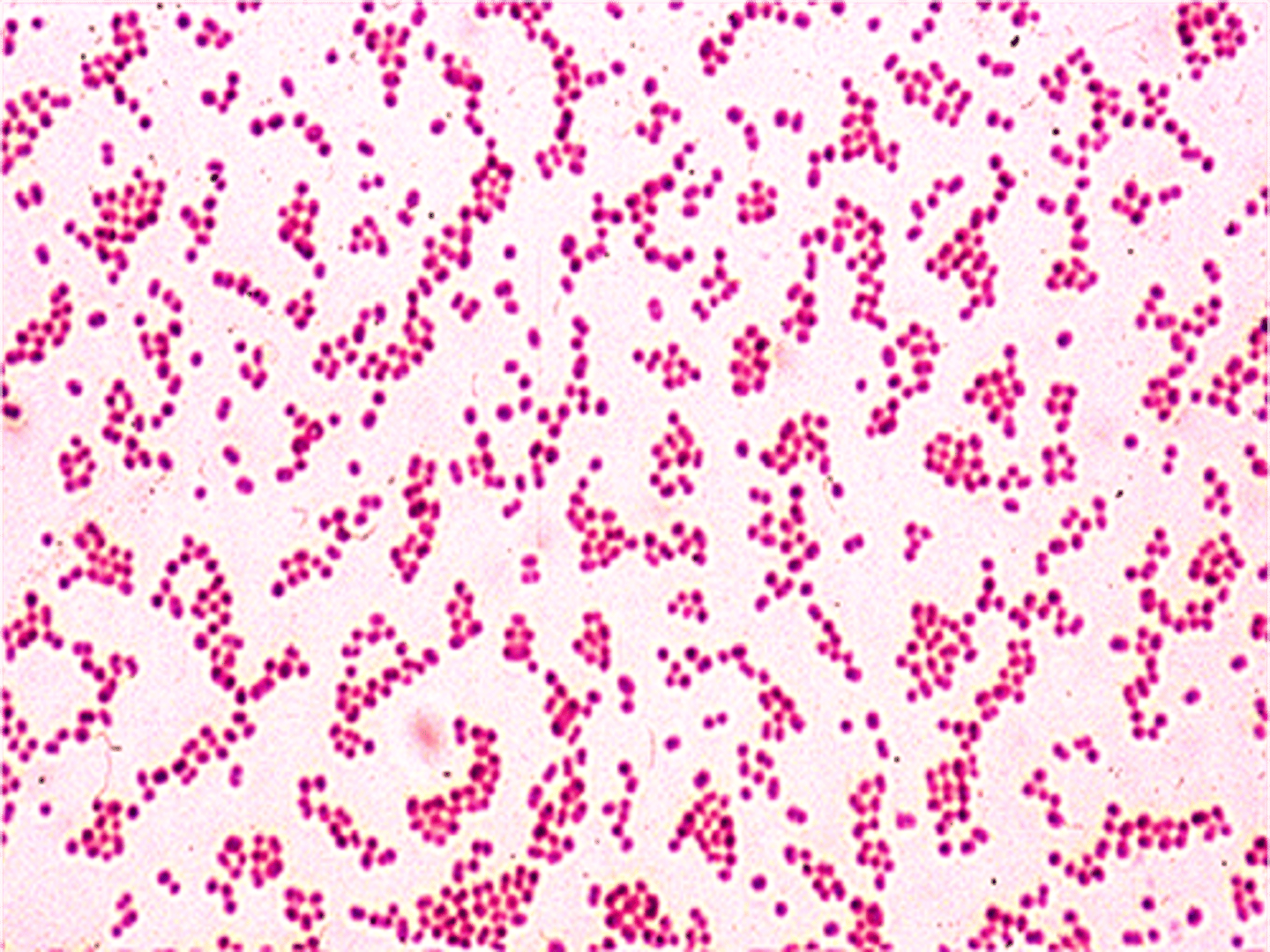 <p>Acinetobacter baumannii</p>