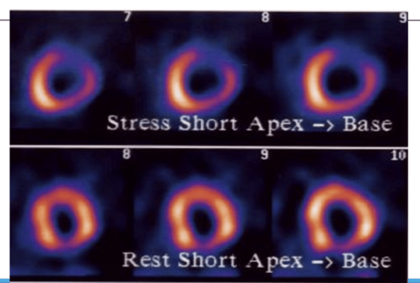 <p>⚬Assess regional blood flow of the coronary arteries-blood supply to heart muscle</p>