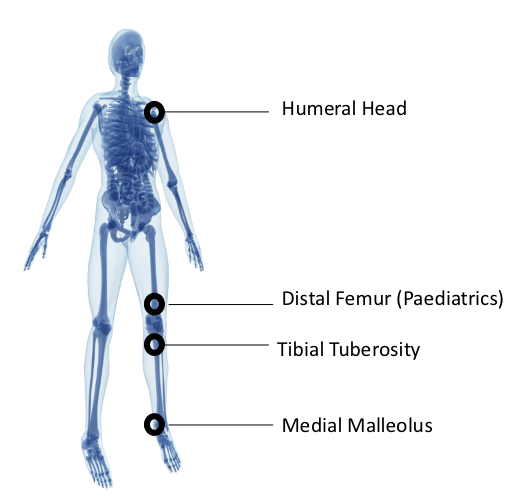 <ul><li><p>humeral head </p></li><li><p>distal femur (paeds)</p></li><li><p>tibial tuberosity </p></li><li><p>medial malleolus </p></li></ul><p>bilaterally!!!</p>