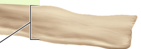 <p>Label</p>