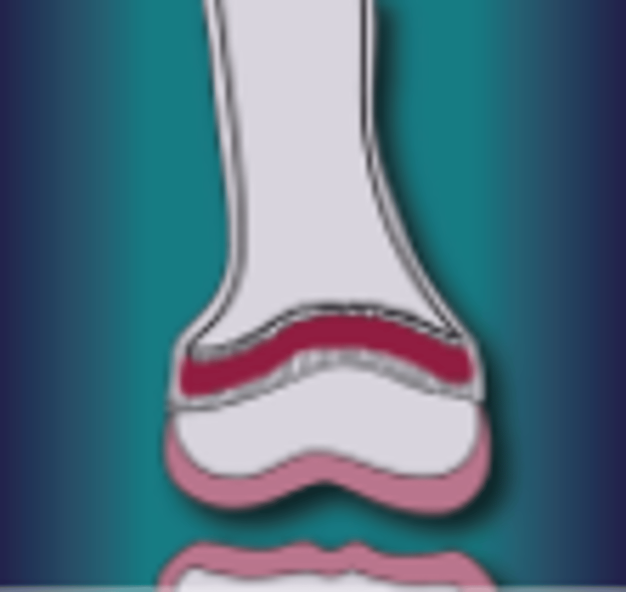 <p>What injury is this</p>