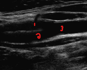 <p>Label the structures on this image.&nbsp;</p>