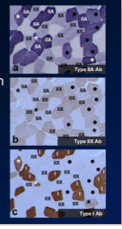 \-since they coexpress differente myosin ATPases, people think that they are in this stage of transition to a different type 

\-but these fibres also exist in untrained individuals 

\-and in post training, these fibres are actyally LOWER (maybe bc they already transitioned to new type bc of training?) 