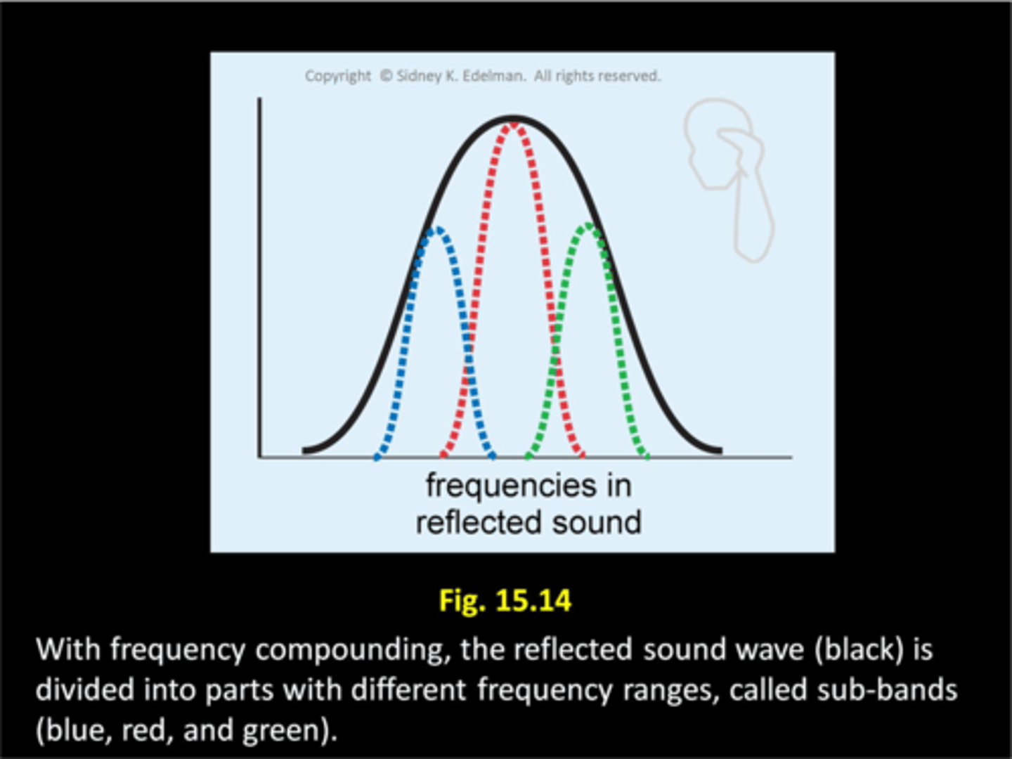 <p>large; sub-bands; limited</p>