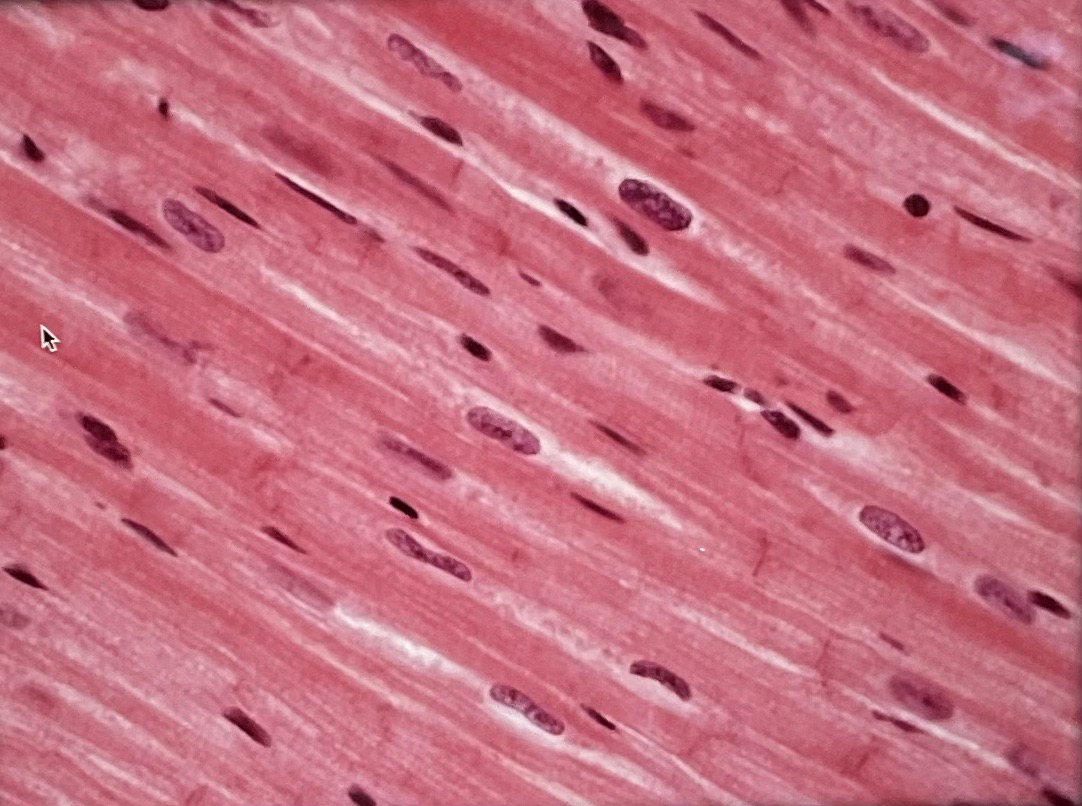 <p>What tissue muscle type is this? What is its function?</p>