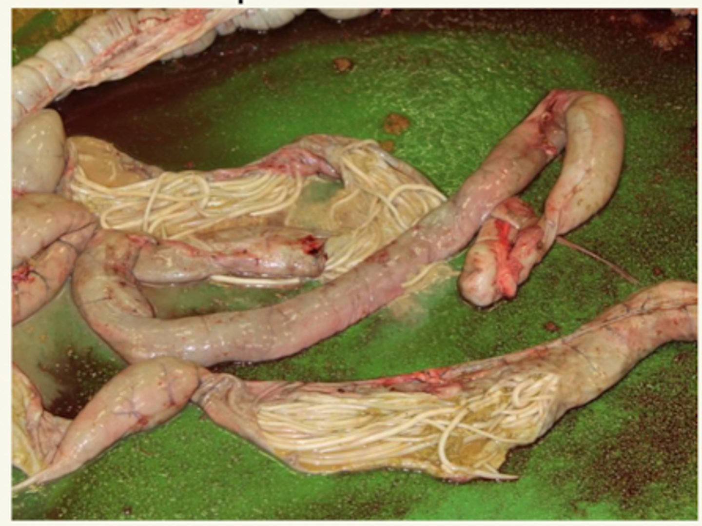 <p>¿etiología?</p>