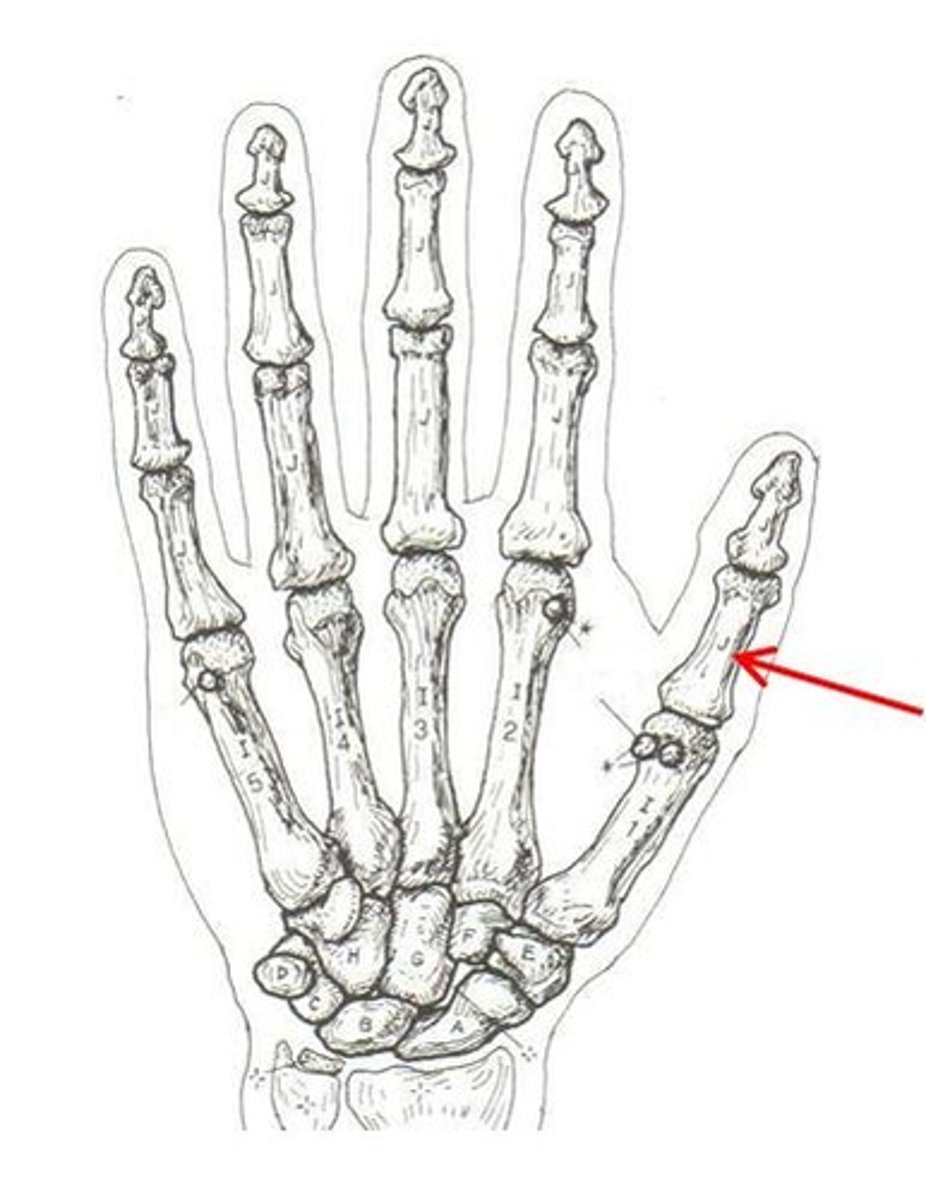 <p>ID bone</p>