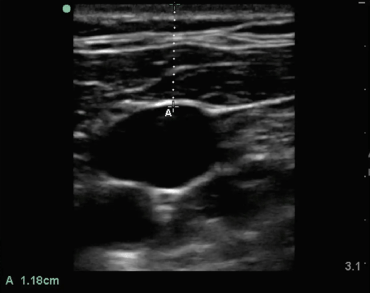 <p>what type of transducer produced this image?</p>
