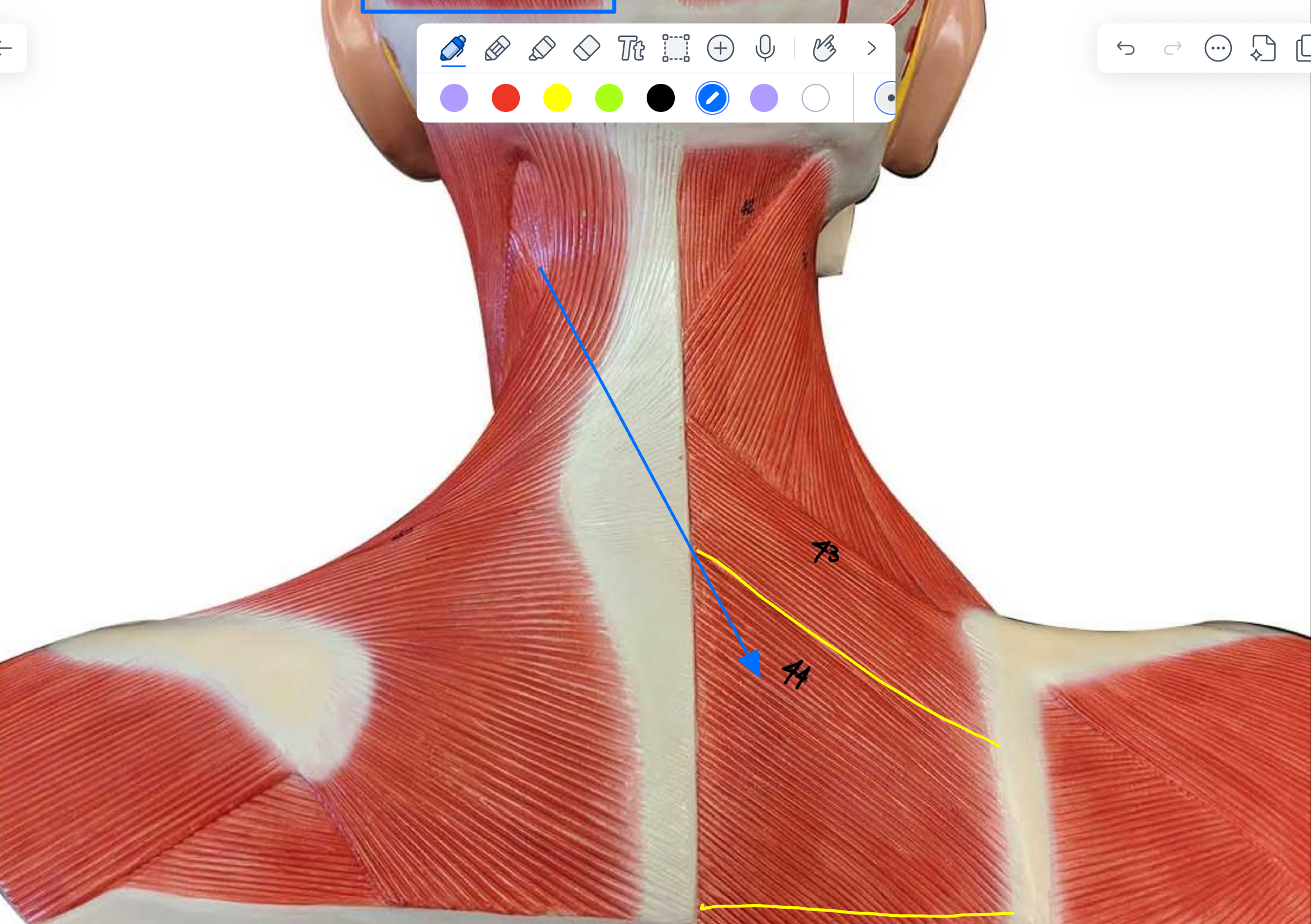 <p>What type of muscle is this ( altay )</p>
