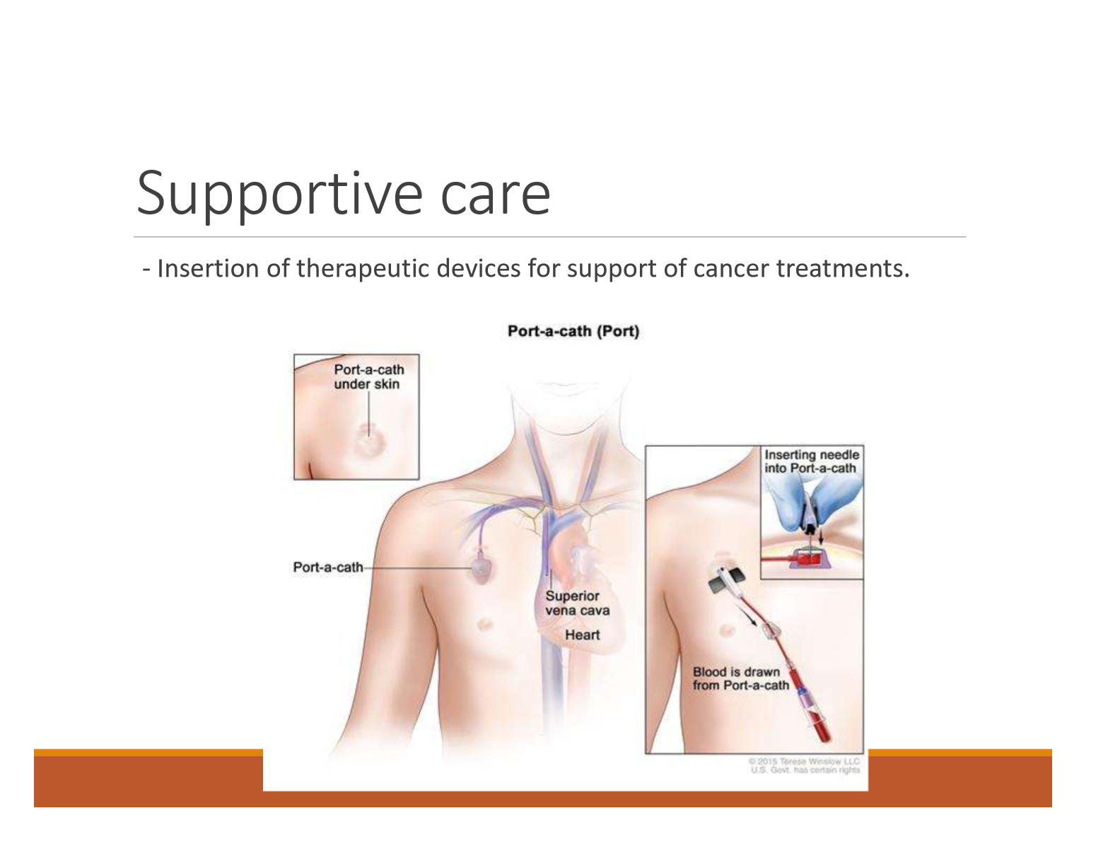<p>Insertion of therapeutic devices for support of cancer treatment.</p>