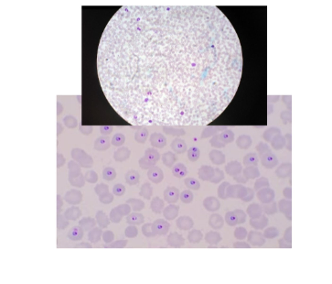 <p>What DISEASE is caused by this organism?</p>