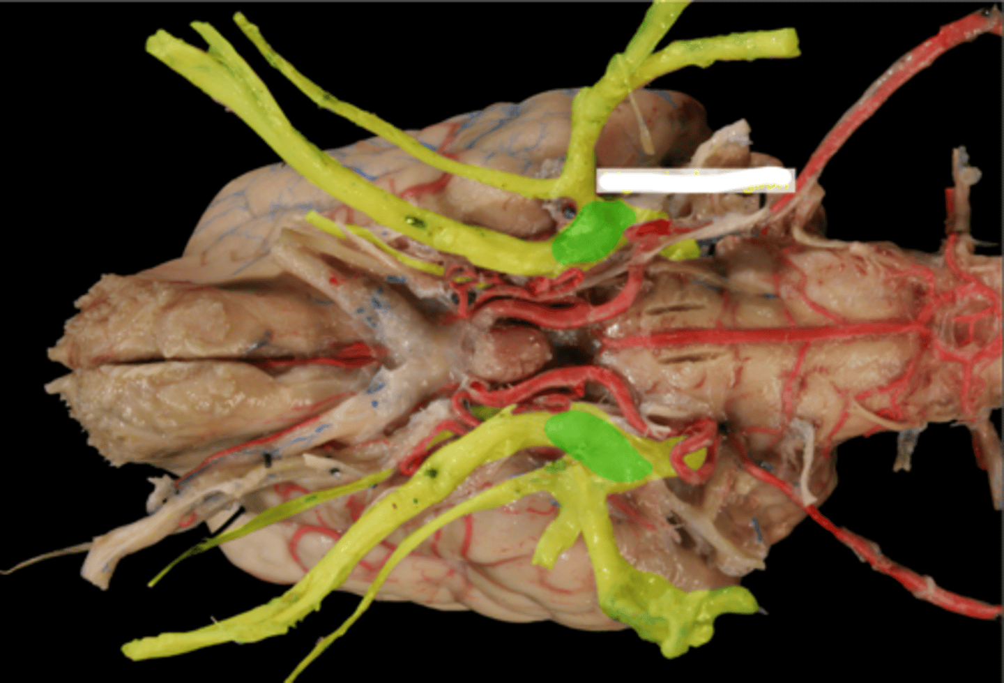 <p>What is the green highlighted region?</p>