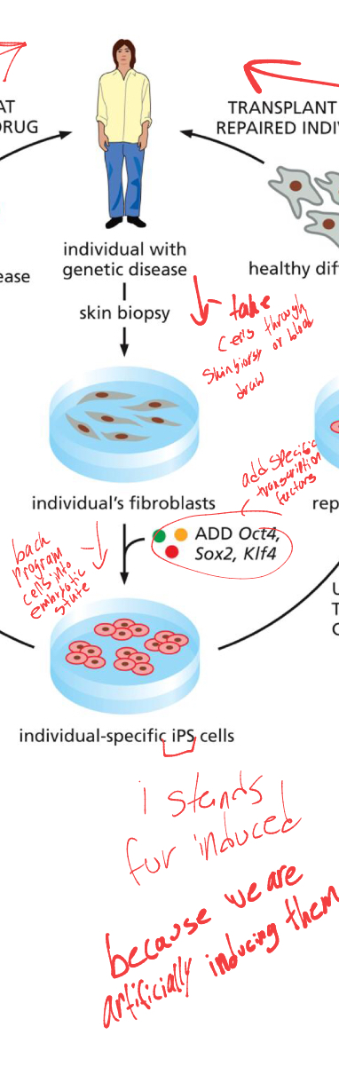 <p>taking an ill persons cells through blood draw, </p><ul><li><p>then adding 4 certain transcription factors (also called yamanaka factors). that back program cells into embryonic like-state. </p></li></ul><p></p>
