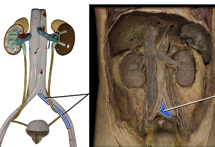 <p>drains blood from leg</p>