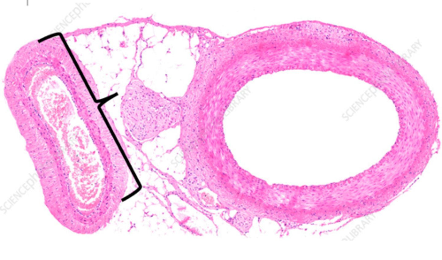<p>a blood vessel that carries blood back to the heart.</p>