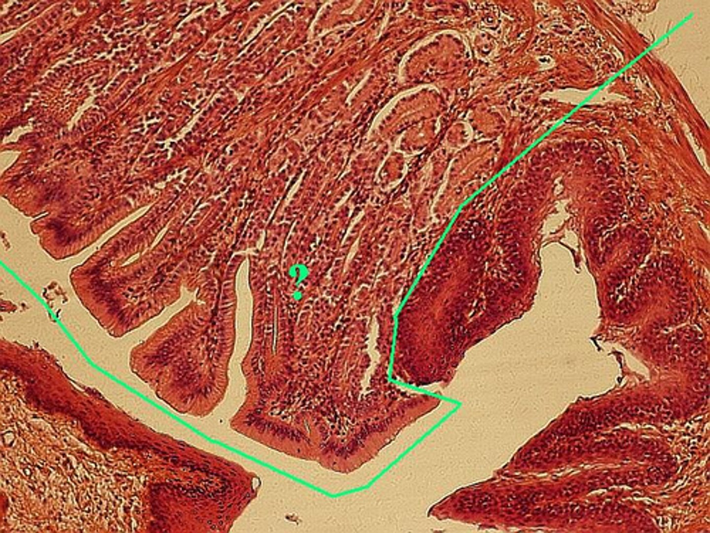 <p>Which portion of the gastroesophogeal junction is indicated?</p>