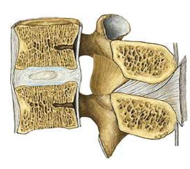 <ul><li><p><span style="color: green;">äußere fibröser Faserring</span></p></li></ul><p></p><ul><li><p><span style="color: rgb(255, 204, 0);">Bandscheibenkern (Gallertkern)</span></p></li></ul><p></p>