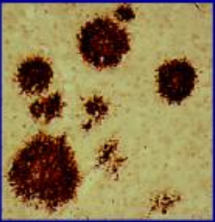<p>Environ <span style="color: rgb(255, 0, 0);">42  AA </span>normalement pas présents dans le cerveau. </p><p>Forme des masses sphériques extracellulaires d’un diamètre de 5 à 100 μm</p>