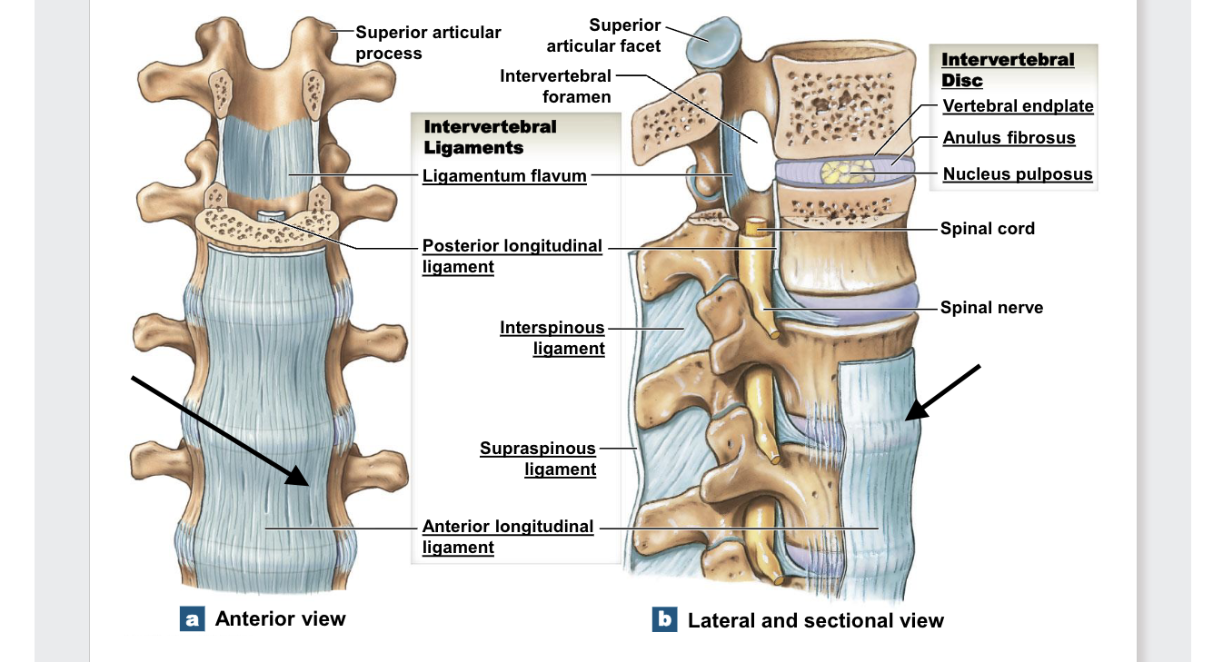 <p>Anterior longitudinal ligament</p>