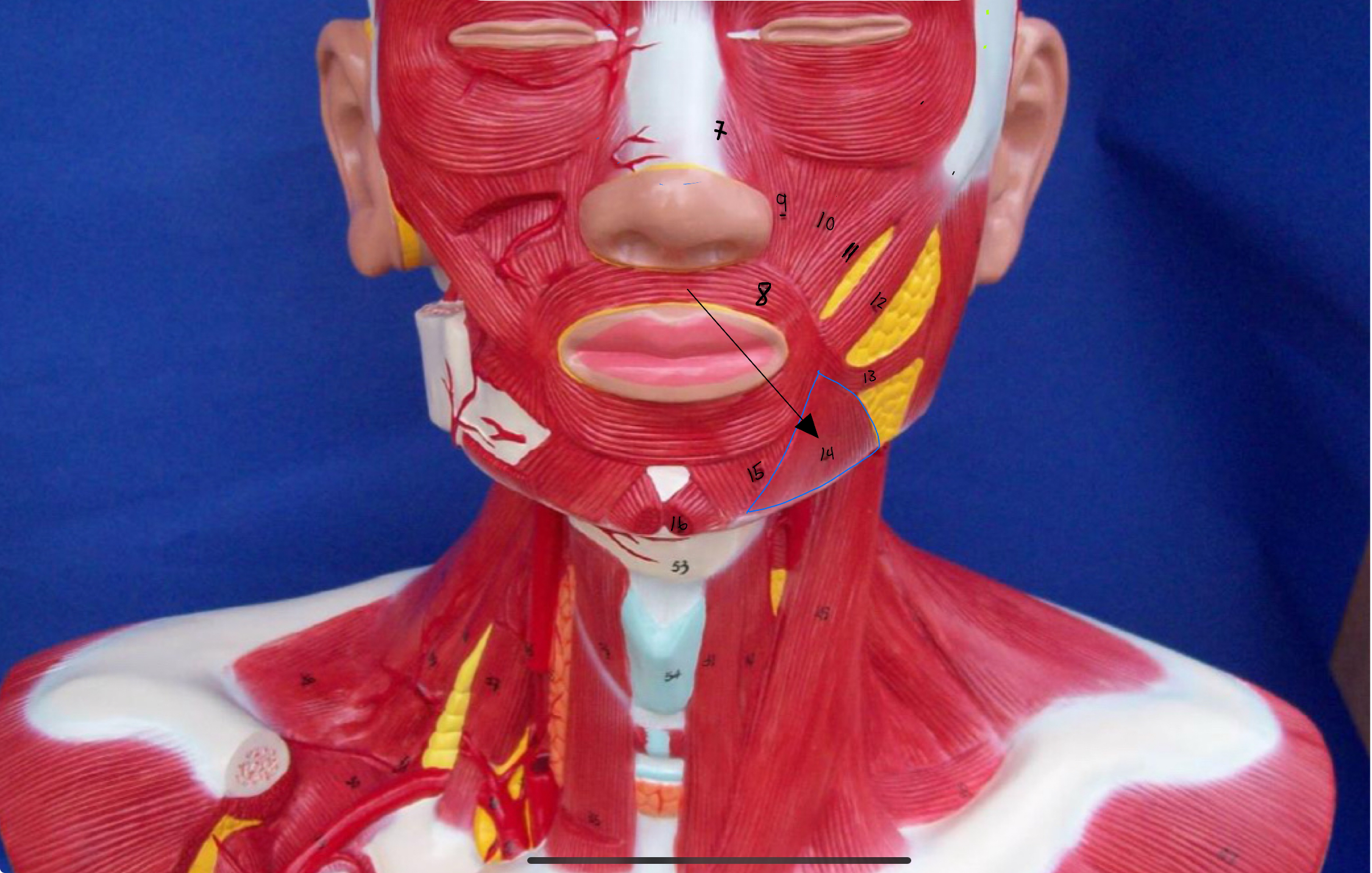 <p>What type of muscle is this (altay model )</p>