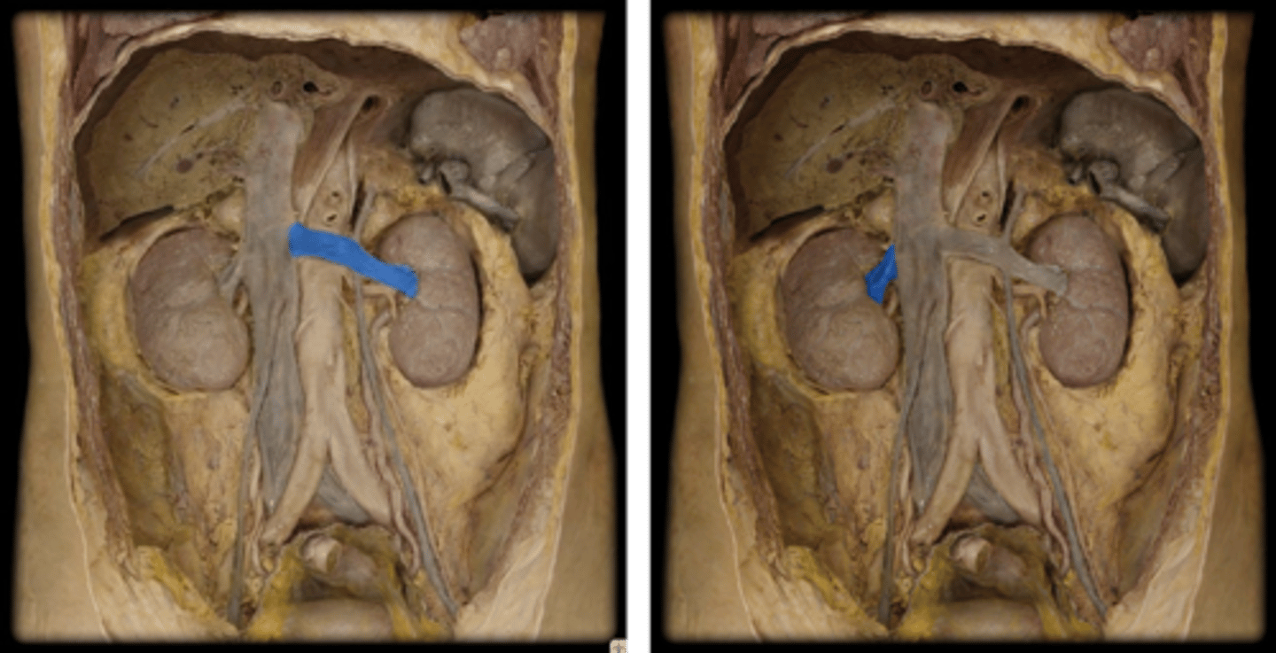<p>Name these vessels.</p>