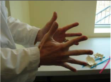 <p>Identify the Cranial Strain Pattern:</p>