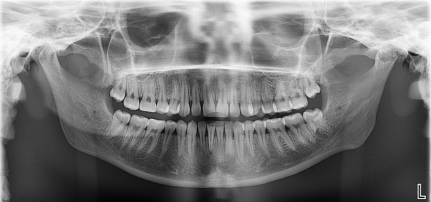 <p>This is the area that we want to see in focus without distortion.</p>