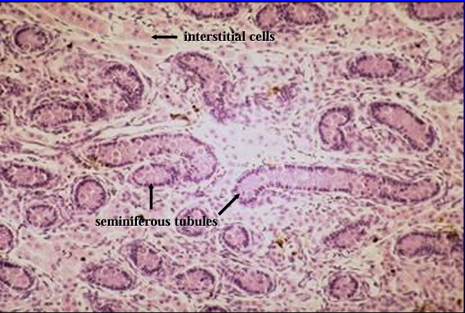<p>Seminiferous tubules and interstitial tissue of testis of 1-day old pig.</p>